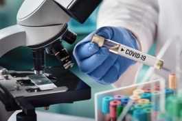Coronavirus: Abruzzo, dati aggiornati al 24 luglio. Oggi 4 nuovi casi positivi
