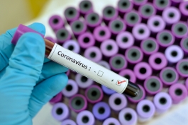 Coronavirus: Abruzzo, dati aggiornati al 16 giugno.