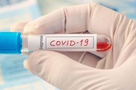 Coronavirus Abruzzo, dati aggiornati all’8 settembre